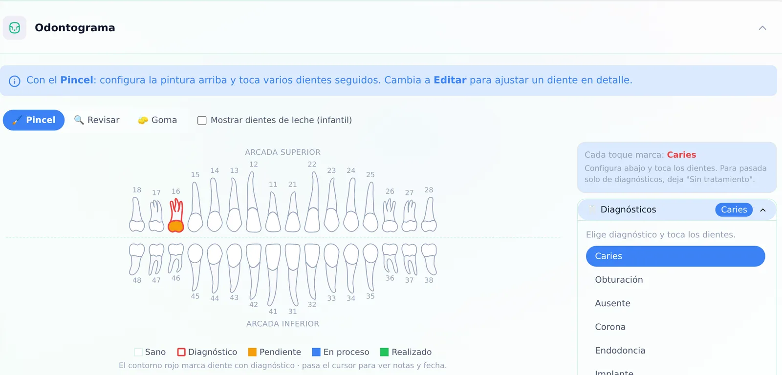 Odontograma digital de Lealify Dental: arcadas superior e inferior en numeración FDI, diente 16 marcado con caries, casilla para mostrar dientes de leche y catálogo de diagnósticos